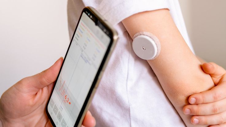 Stelo CGM System Insights: Improving Diabetes Care with Real-Time Data stelo cgm Stelo CGM System Insights: Improving Diabetes Care with Real-Time Data